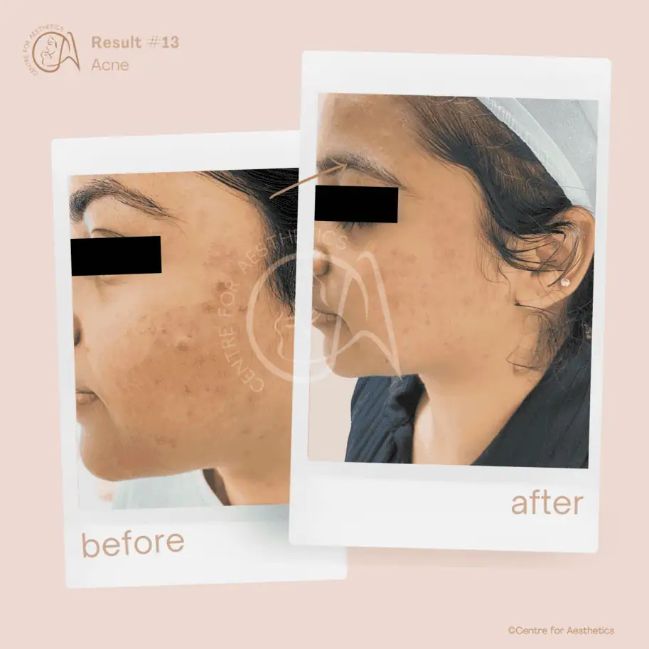 Centre for Aesthetics team in Gurgaon